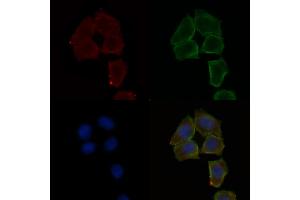 ABIN6257862 and ABIN6275231 staining Hela cells(30 min of UV treatment) by IF/ICC.