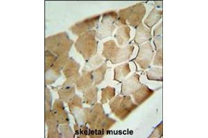 CDKN2C Antibody immunohistochemistry analysis in formalin fixed and paraffin embedded human skeletal muscle followed by peroxidase conjugation of the secondary antibody and DAB staining. (CDKN2C Antikörper  (C-Term))