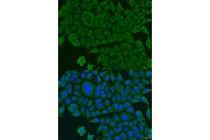 Immunofluorescence analysis of U2OS cells using BCS1L antibody (ABIN2736351) at dilution of 1:100.