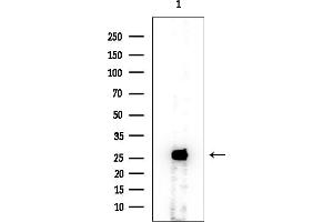 anti-Glutathione S-Transferase mu 5 (GSTM5) (N-Term) antibody