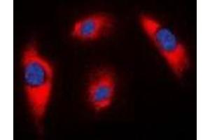 Immunofluorescent analysis of MRPS18C staining in K562 cells. (MRPS18C Antikörper)