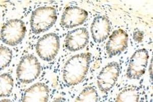 Immunohistochemistry analysis of paraffin-embedded human colon using,SIN1 (ABIN7074669) at dilution of 1: 500
