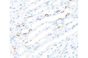 Immunohistochemistry of paraffin-embedded Mouse kidney using FGF10 Polyclonal Antibody at dilution of 1:100 (40x lens). (FGF10 Antikörper)