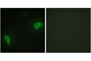 Immunofluorescence analysis of HepG2 cells, using DOK7 Antibody. (DOK7 Antikörper  (AA 10-59))