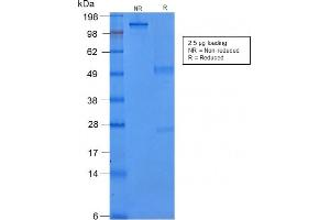 SDS-PAGE Analysis Purified Cytokeratin 8 Mouse Recombinant Monoclonal Antibody (rB22.