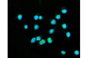 IF analysis of CENPB using anti-CENPB antibody (ABIN7602867). (CENPB Antikörper  (C-Term))
