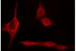 ABIN6274715 staining HepG2 cells by IF/ICC. (PSMD12 Antikörper  (Internal Region))