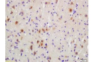 Formalin-fixed and paraffin embedded rat brain labeled with Rabbit Anti-MKK3(Ser218)/MKK6(Ser207) Polyclonal Antibody, Unconjugated  at 1:200 followed by conjugation to the secondary antibody and DAB staining (MAP2K3 Antikörper  (pSer207))