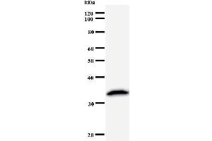 Western Blotting (WB) image for anti-PRP8 Pre-mRNA Processing Factor 8 (PRPF8) antibody (ABIN933118) (PRPF8 Antikörper)
