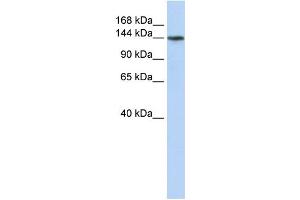 WB Suggested Anti-ATP11B Antibody Titration:  0. (ATP11B Antikörper  (N-Term))