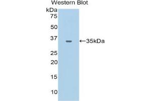 Western blot analysis of the recombinant protein. (CEACAM1 Antikörper  (AA 35-320))