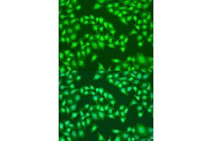 Immunofluorescence analysis of U2OS cells using RS antibody (ABIN7269832) at dilution of 1:100.
