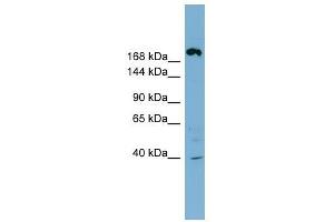 ABCC11 antibody used at 1 ug/ml to detect target protein.