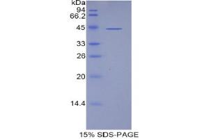 SDS-PAGE analysis of Human Lipocalin 15 Protein. (LCN15 Protein)