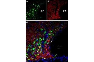 Multiplex staining of AT2 receptor and VGLUT2 in rat supraoptic hypothalamic nucleus - Immunohistochemical staining of perfusion-fixed frozen rat brain sections using Anti-Angiotensin II Receptor Type-2 (extracellular)-ATTO Fluor-488 Antibody (ABIN7042926), (1:60) and Anti-VGLUT2-ATTO Fluor-594 Antibody (ABIN7043682), (1:60). (Angiotensin II Type 2 Receptor Antikörper  (Extracellular) (Atto 488))