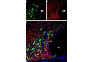 Multiplex staining of AT2 receptor and VGLUT2 in rat supraoptic hypothalamic nucleus - Immunohistochemical staining of perfusion-fixed frozen rat brain sections using Anti-Angiotensin II Receptor Type-2 (extracellular)-ATTO Fluor-488 Antibody (ABIN7042926), (1:60) and Anti-VGLUT2-ATTO Fluor-594 Antibody (ABIN7043682), (1:60). (Angiotensin II Type 2 Receptor Antikörper  (Extracellular, N-Term) (Atto 488))