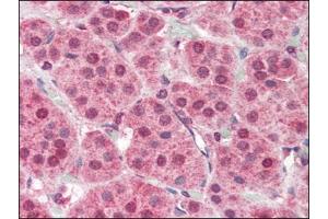 Human Adrenal (formalin-fixed, paraffin-embedded) stained with PARP2at 2. (PARP2 Antikörper  (Internal Region))