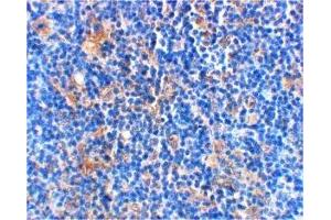 Immunohistochemistry (IHC) image for anti-BCL2-Associated Agonist of Cell Death (BAD) (C-Term) antibody (ABIN1030278) (BAD Antikörper  (C-Term))