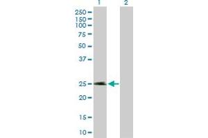 Western Blot analysis of NECAB2 expression in transfected 293T cell line by NECAB2 MaxPab polyclonal antibody. (NECAB2 Antikörper  (AA 1-239))