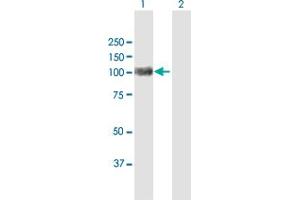 Western Blot analysis of ACO1 expression in transfected 293T cell line by ACO1 MaxPab polyclonal antibody. (Aconitase 1 Antikörper  (AA 1-889))