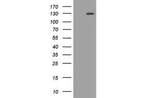 Image no. 1 for anti-Fibroblast Growth Factor Receptor 3 (FGFR3) (AA 23-375) antibody (ABIN1491237) (FGFR3 Antikörper  (AA 23-375))