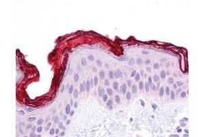 DBT antibody was used for immunohistochemistry at a concentration of 4-8 ug/ml. (DBT Antikörper  (N-Term))