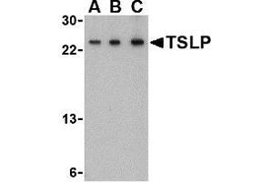 Western Blotting (WB) image for anti-Thymic Stromal Lymphopoietin (TSLP) (Middle Region) antibody (ABIN1031147)