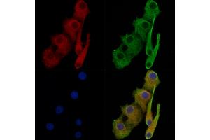 ABIN7093772 and ABIN7097813 staining Hela cells by IF/ICC. (beta Catenin Antikörper)
