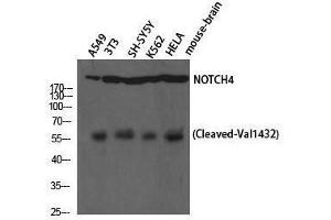 Western Blotting (WB) image for anti-Notch 4 (NOTCH4) (cleaved), (Val1432) antibody (ABIN3172780) (NOTCH4 Antikörper  (cleaved, Val1432))