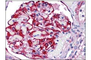 Human Kidney: Formalin-Fixed, Paraffin-Embedded (FFPE) (FREM2 Antikörper)