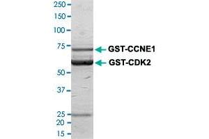Image no. 1 for Cyclin-Dependent Kinase 2 (CDK2) (AA 1-298) (Active) protein (GST tag) (ABIN5569591)