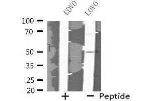 Western blot analysis of extracts from LOVO cells, using FOXN4 antibody. (FOXN4 Antikörper  (C-Term))