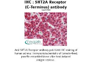 Image no. 1 for anti-5-Hydroxytryptamine (serotonin) Receptor 2A (HTR2A) (C-Term) antibody (ABIN1731361) (HTR2A Antikörper  (C-Term))