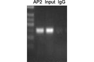 ChIP analysis of Cervical cancer cell lines lysate, incubated for 12 hours at 4°C. (AP2 alpha/beta (C-Term) Antikörper)