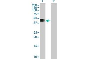 Western Blot analysis of ZNRF4 expression in transfected 293T cell line by ZNRF4 MaxPab polyclonal antibody. (ZNRF4 Antikörper  (AA 1-429))