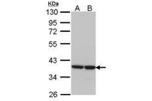 Image no. 1 for anti-Aldo-Keto Reductase Family 1, Member B1 (Aldose Reductase) (AKR1B1) (AA 1-298) antibody (ABIN467605) (AKR1B1 Antikörper  (AA 1-298))