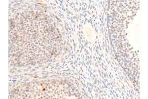 Immunohistochemistry (IHC) image for anti-Myc Proto-Oncogene protein (MYC) (pThr58) antibody (ABIN6256584)
