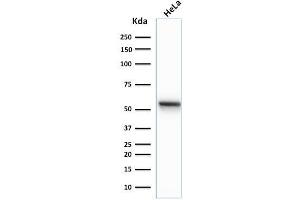 Western Blot Analysis of human HeLa cell lysate using Cytokeratin 7 Mouse Monoclonal Antibody (K72. (Cytokeratin 7 Antikörper)