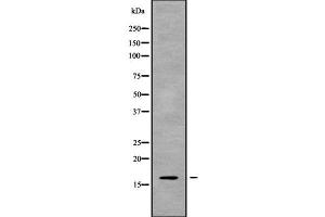 Western blot analysis of CST8 using Jurkat whole cell lysates (CST8 Antikörper  (Internal Region))