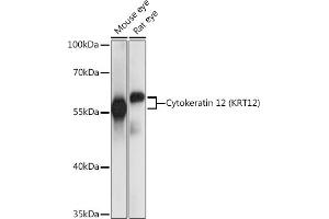 Western blot analysis of extracts of various cell lines, using Cytokeratin 12 (Cytokeratin 12 (KRT12)) antibody (ABIN7268088) at 1:1000 dilution. (KRT12 Antikörper  (AA 295-494))