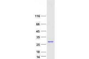 Western Blotting (WB) image for Ubiquitin-Conjugating Enzyme E2F (UBE2F) protein (Myc-DYKDDDDK Tag) (ABIN2726886)
