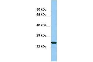 Host: Rabbit Target Name: B9D1 Sample Type: 721_B Whole Cell lysates Antibody Dilution: 1. (B9D1 Antikörper  (N-Term))