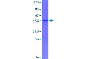 m1ip1 Protein (AA 1-183) (GST tag)