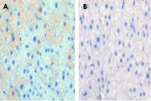 Formalin-fixed and paraffin-embedded cow lactatingreacted with CPT1A polyclonal antibody , which was peroxidase-conjugated to the secondary antibody, followed by AEC staining. (CPT1A Antikörper  (C-Term))