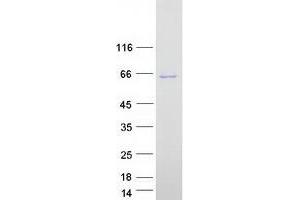 Validation with Western Blot