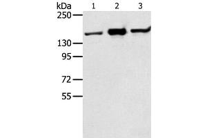 Western Blot analysis of Jurkat, K562 and hela cell using STAG2 Polyclonal Antibody at dilution of 1:350 (STAG2 Antikörper)