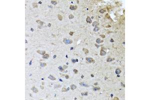 Immunohistochemistry of paraffin-embedded mouse brain using BRCA1 antibody (ABIN5970045) at dilution of 1/100 (40x lens). (BRCA1 Antikörper)