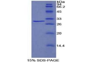 SDS-PAGE analysis of Rat TRADD Protein. (TRADD Protein)