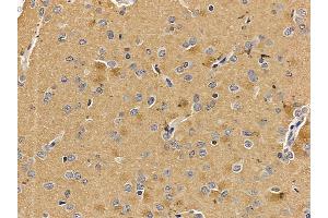 OPRM1 Mouse Monoclonal Antibody at 1/100 staining rat brain tissue by IHC-P. (Mu Opioid Receptor 1 Antikörper  (C-Term))