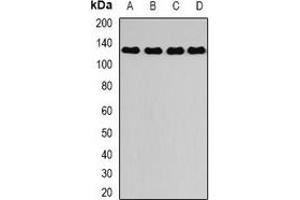 Western blot analysis of DAAM2 expression in A375 (A), mouse kidney (B), mouse lung (C), rat brain (D) whole cell lysates. (DAAM2 Antikörper)